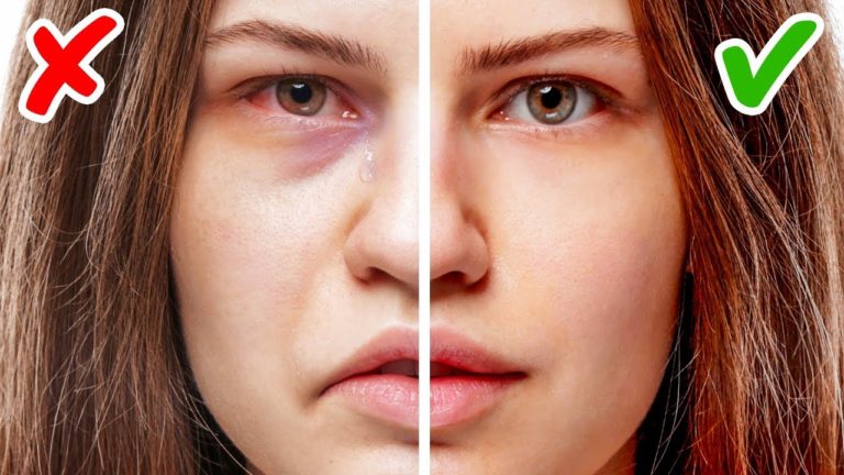 11 Signs of Health Problems Hidden On Your Face