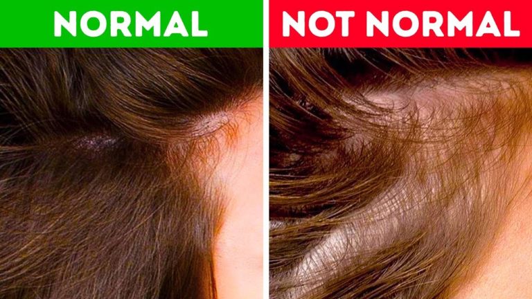 What Your Hair Can Tell You About Your Health