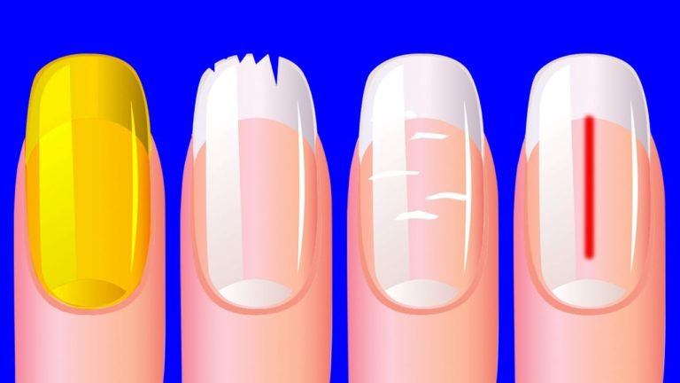 What Your Nails Say About Your Health