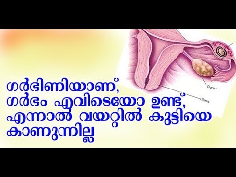 ആള് ഗര്‍ഭിണി ആണ് ..സ്കാന്‍ ചെയ്തിട്ടും കുട്ടിയെ കാണുന്നില്ല | Khairu Jasmi Health Tips .