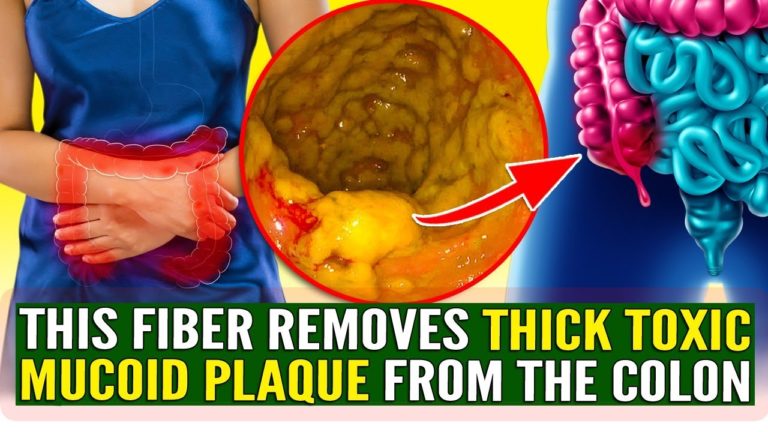 BOWEL HEALTH: This Soluble Fiber Will Remove Thick And Toxic Mucoid Plaque From Your Colon!