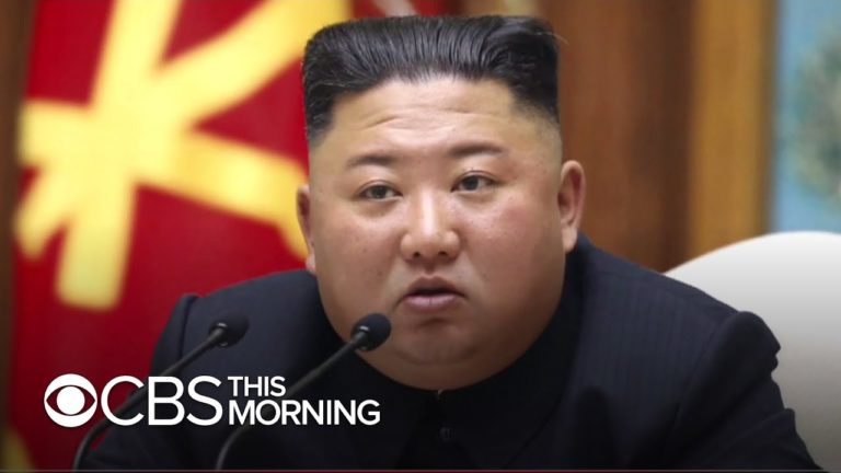 Health of North Korea’s Kim Jong Un in question Health of North Korea’s Kim Jong Un in question