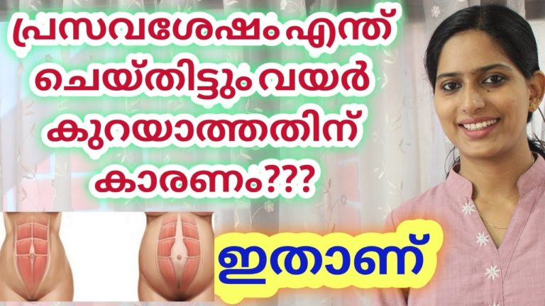 പ്രസവശേഷം വയർ കുറയാതിരിക്കാനുള്ള കാരണം? Diastasis Recti Malayalam. Self Testing. Weekend Fitness #1