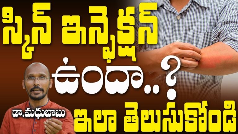 స్కిన్ ఇన్ఫెక్షన్ ఉందా ఇలా తెలుసుకోండి | Dr. Madhu Babu | Health Trends |