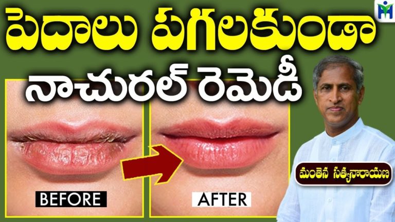 పెదాలు పగలకుండా నాచురల్ రెమెడీ | Manthena Satyanarayana Raju Videos | Health Mantra |