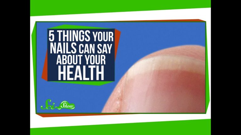 5 Things Your Nails Can Say About Your Health