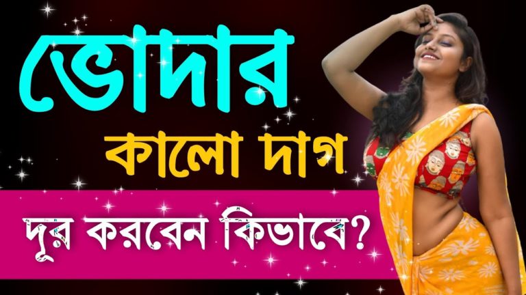 Onger Kalo Dag Dur Korar Upay । Golden Tips Bangla । Bangla Health Tips । Health Care Tips