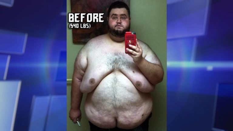 Man’s Incredible Weight Loss and Overcoming Food Addiction