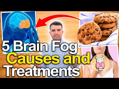 How To Cure Brain Fog – 5 Causes and Treatments For Mental Clarity