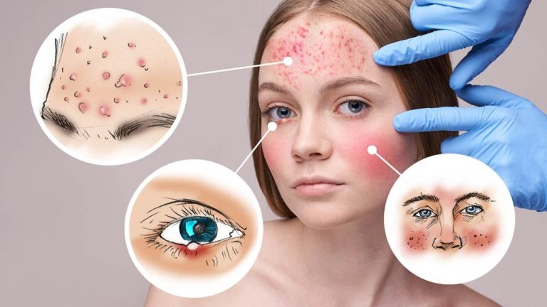 18 Things Your Face Can Tell You about Deep Health Problems 18 Things Your Face Can Tell You about Deep Health Problems