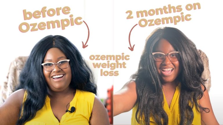 2 Months on Ozempic: weight loss before and after, side effects, injections from a patient’s view